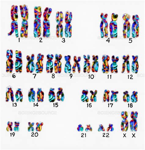 What is the reason. . A karyotype quizlet
